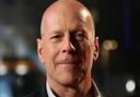 Bruce Willis will retire from acting after being diagnosed wth aphasia (PA)